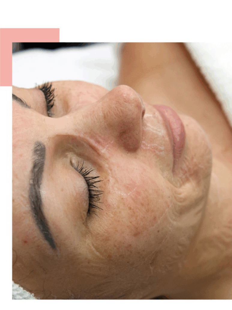 Slow aging booster Slow aging booster MaRo Izegem